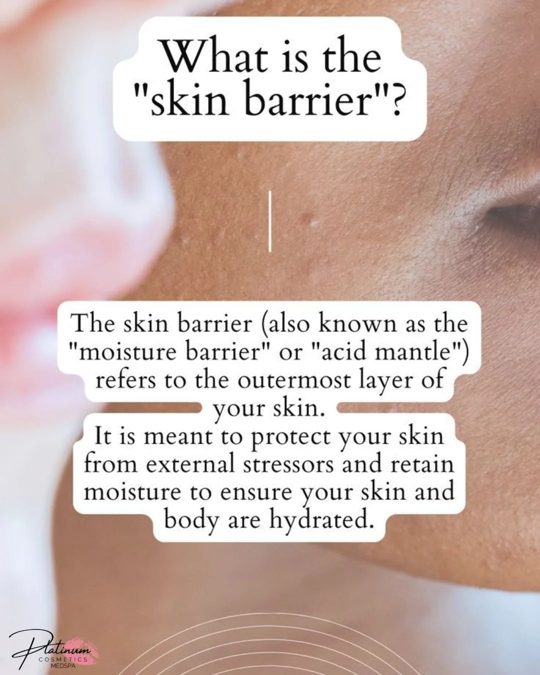Have your products been burning when you apply them? 🔥

This could be a sign that your skin barrier is compromised.

When your barrier is damaged, your skin becomes more sensitive, irritated, and reactive&mdash;even to products you&rsquo;ve always u