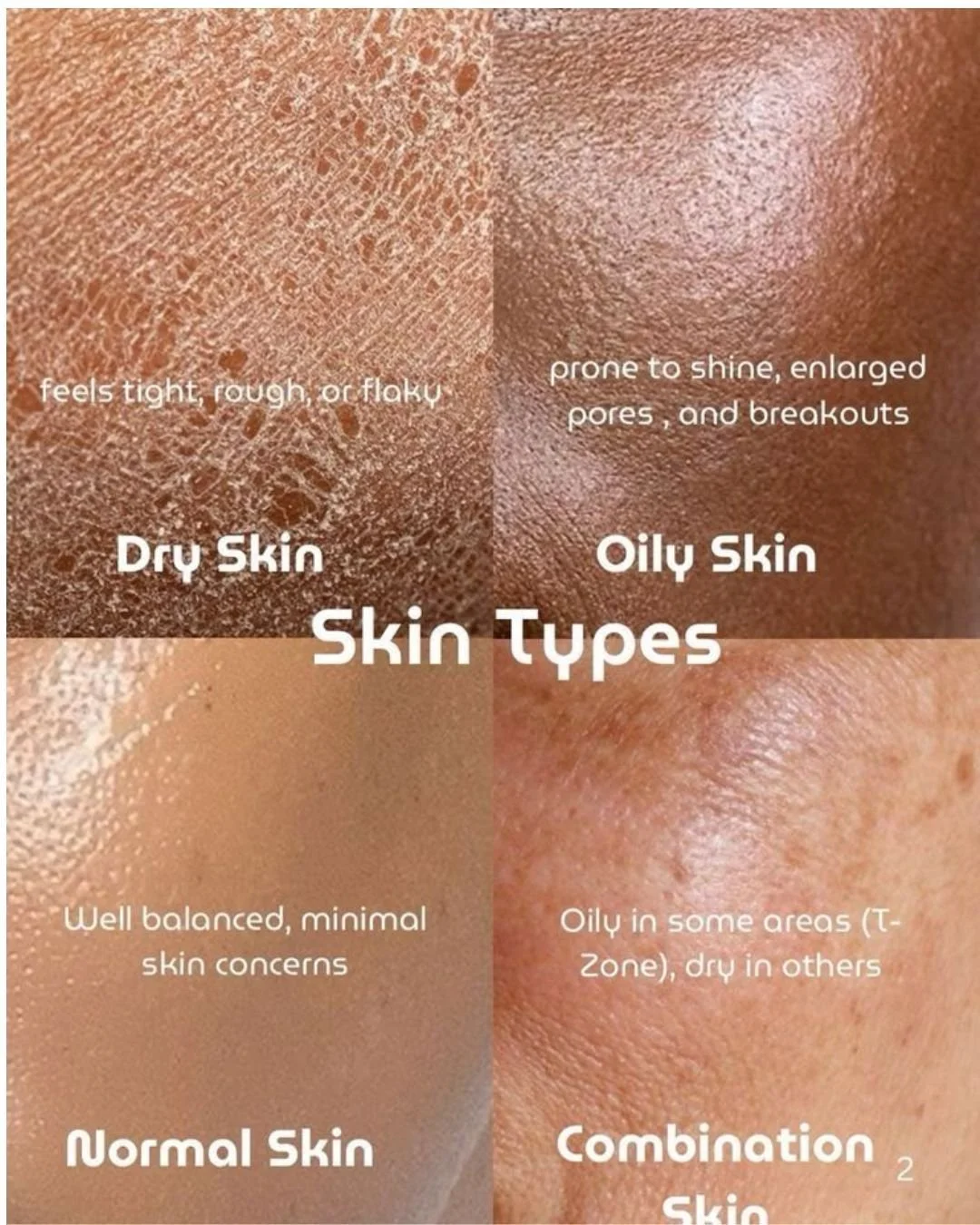 Understanding your skin type is the FIRST step to healthy, glowing skin ✨🤍

The 4 main skin types:

💧 Dry Skin
Feels tight, flaky, or rough and needs extra hydration.

✨ Oily Skin
Produces excess oil and may be more prone to clogged pores and break