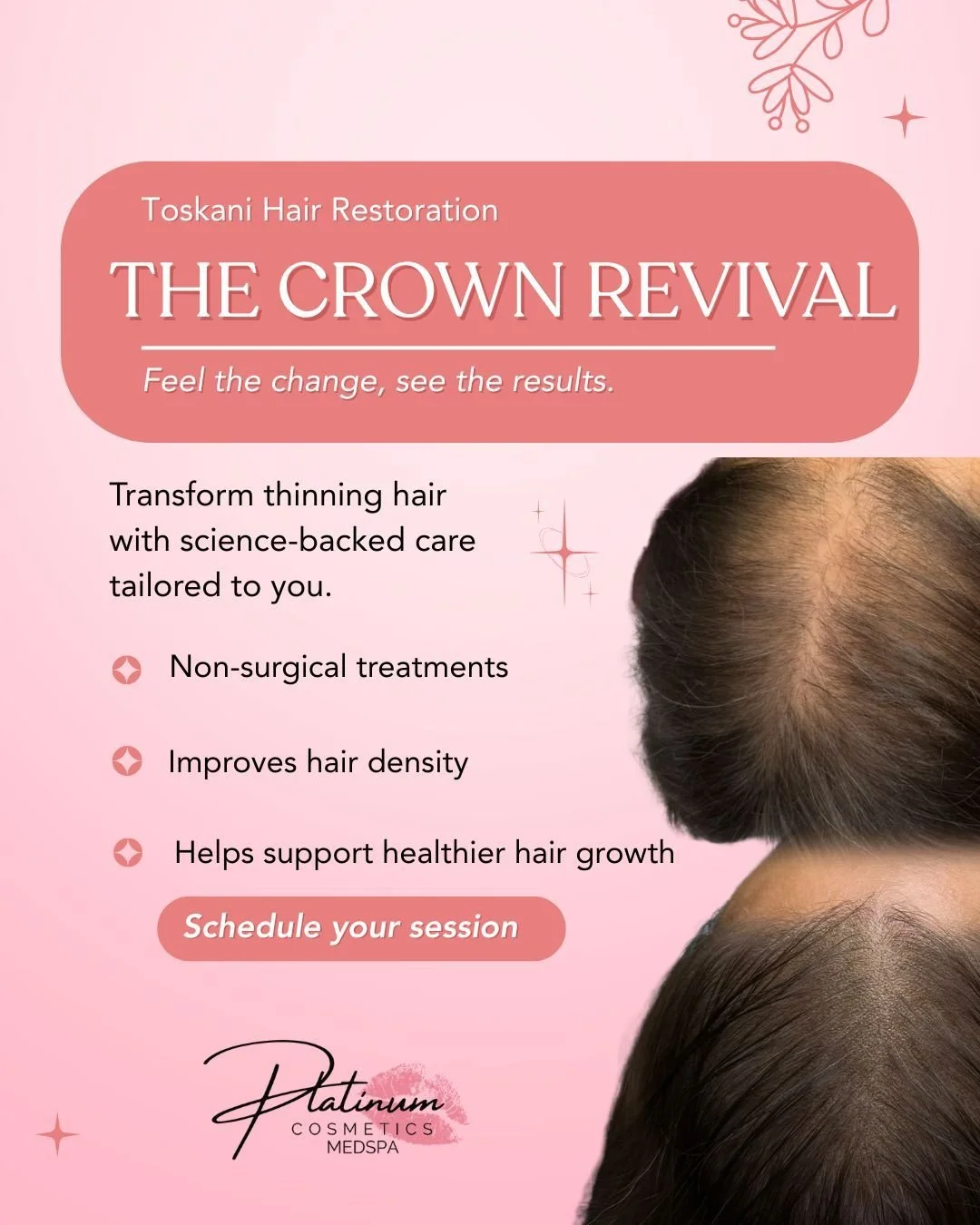 Struggling with thinning hair or shedding? 👀✨

Introducing The Crown Revival by Toskani Hair Restoration 🤍 A non-surgical treatment designed to help improve hair density, support healthier hair growth, and nourish the scalp from the root.

✨ Suppor