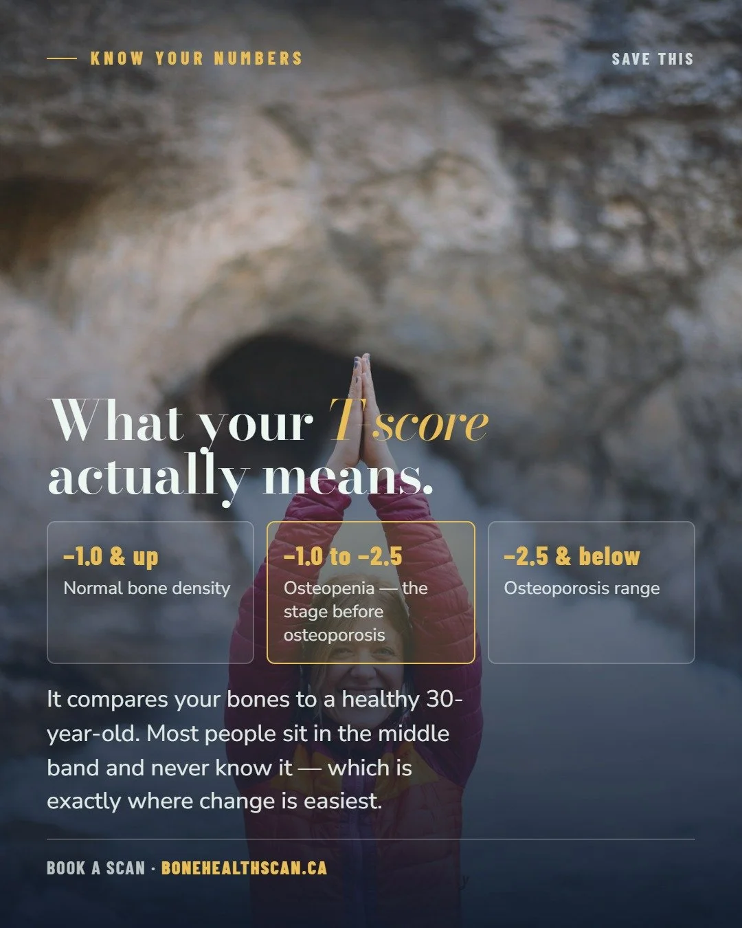 Your T-score, in plain English.

It compares your bone density to a healthy 30-year-old:

✓ &minus;1.0 and above &mdash; normal bone density
✓ &minus;1.0 to &minus;2.5 &mdash; osteopenia, the stage before osteoporosis
✓ &minus;2.5 and below &mdash; o