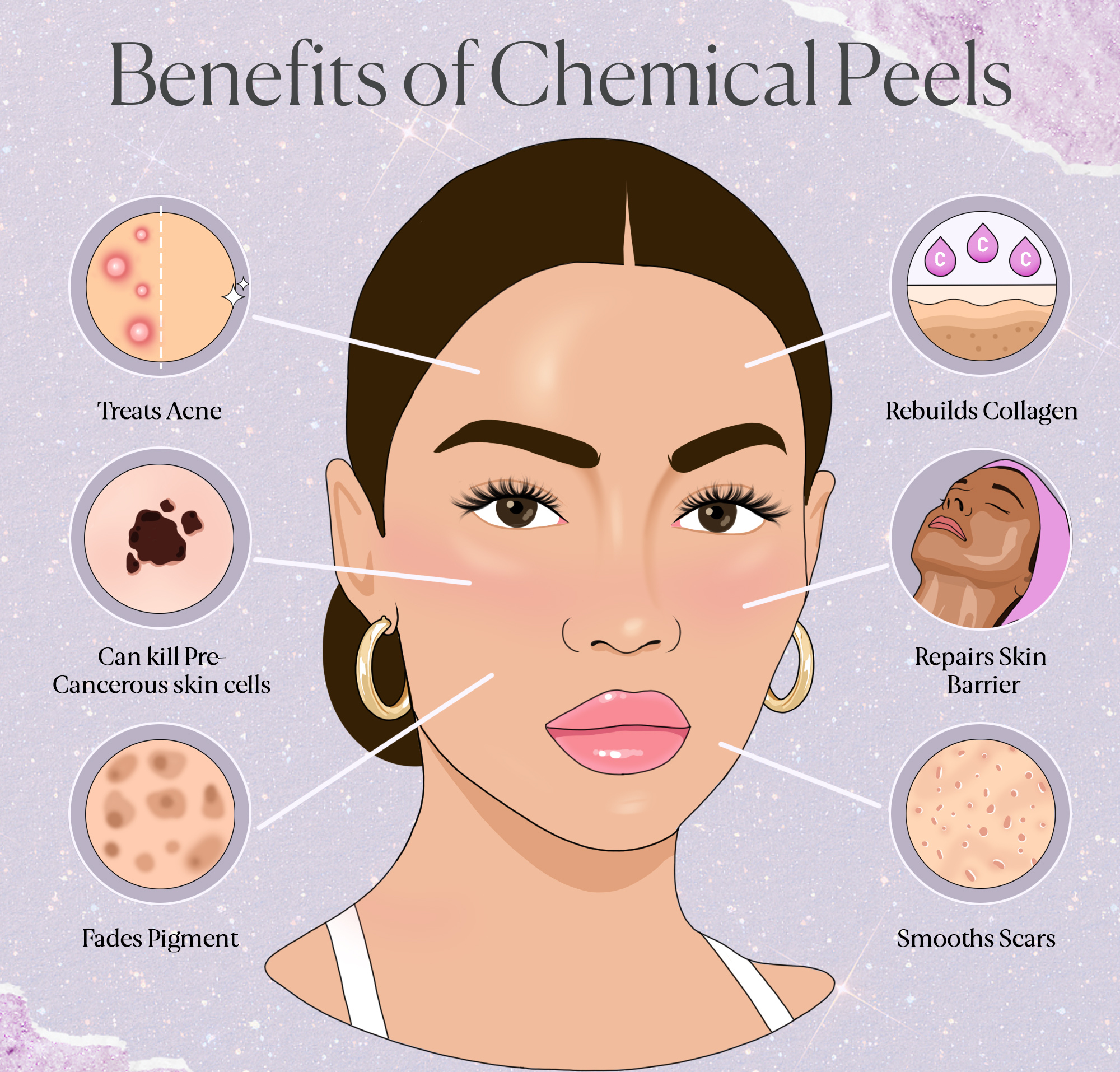 Benefits+of+Chemical+Peels.png