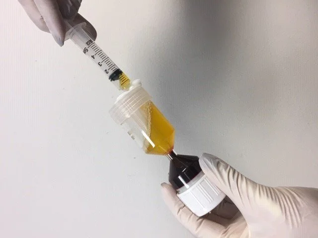 A medical professional using a syringe to extract a plate-rich plasma (PRP) from a medical tube.