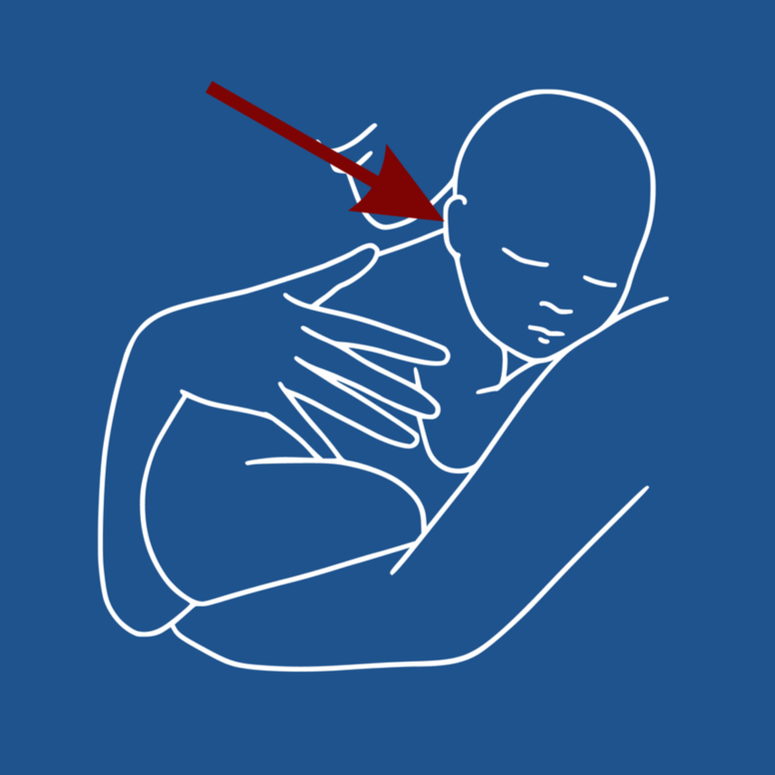 Darlun llinell o berson yn dal babi'n cysgu, gyda saeth goch yn pwyntio at glust y person.