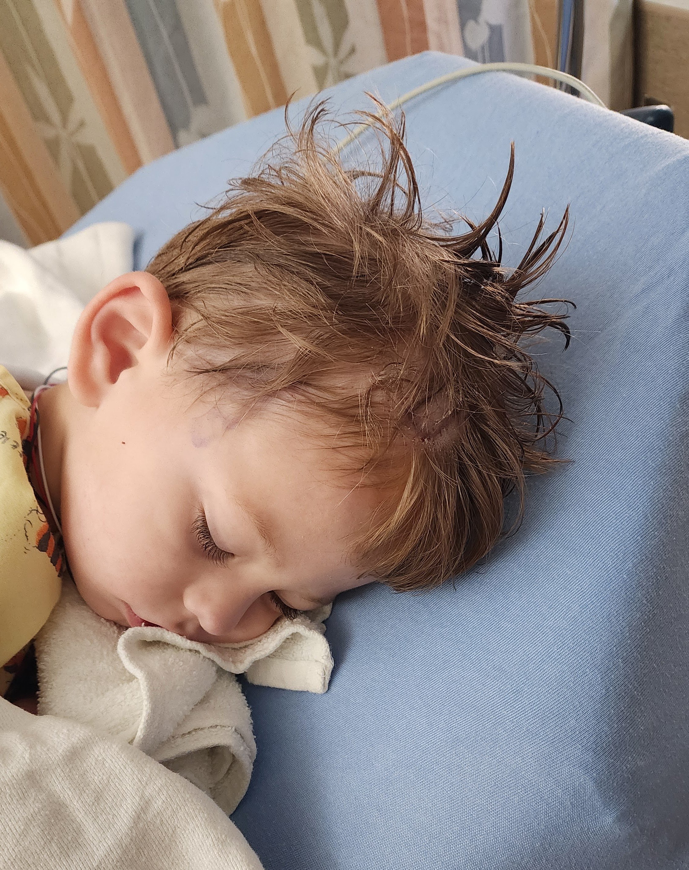 Back in recovery right after surgery