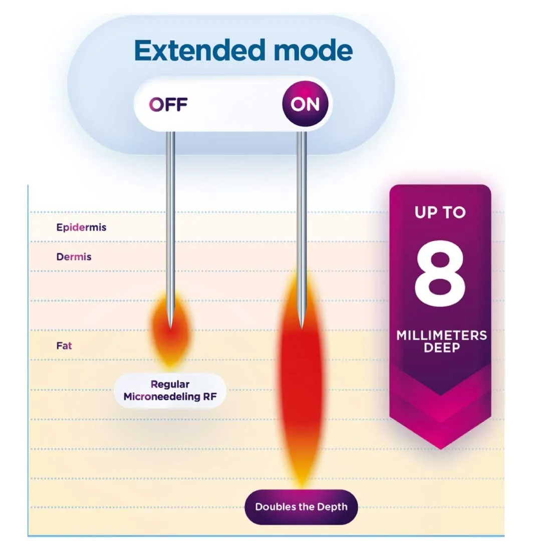 Chart comparing regular microneedling RF with extended mode, showing needle depths up to 8 millimeters deep, doubling the depth with extended mode, with layers labeled from epidermis to fat.