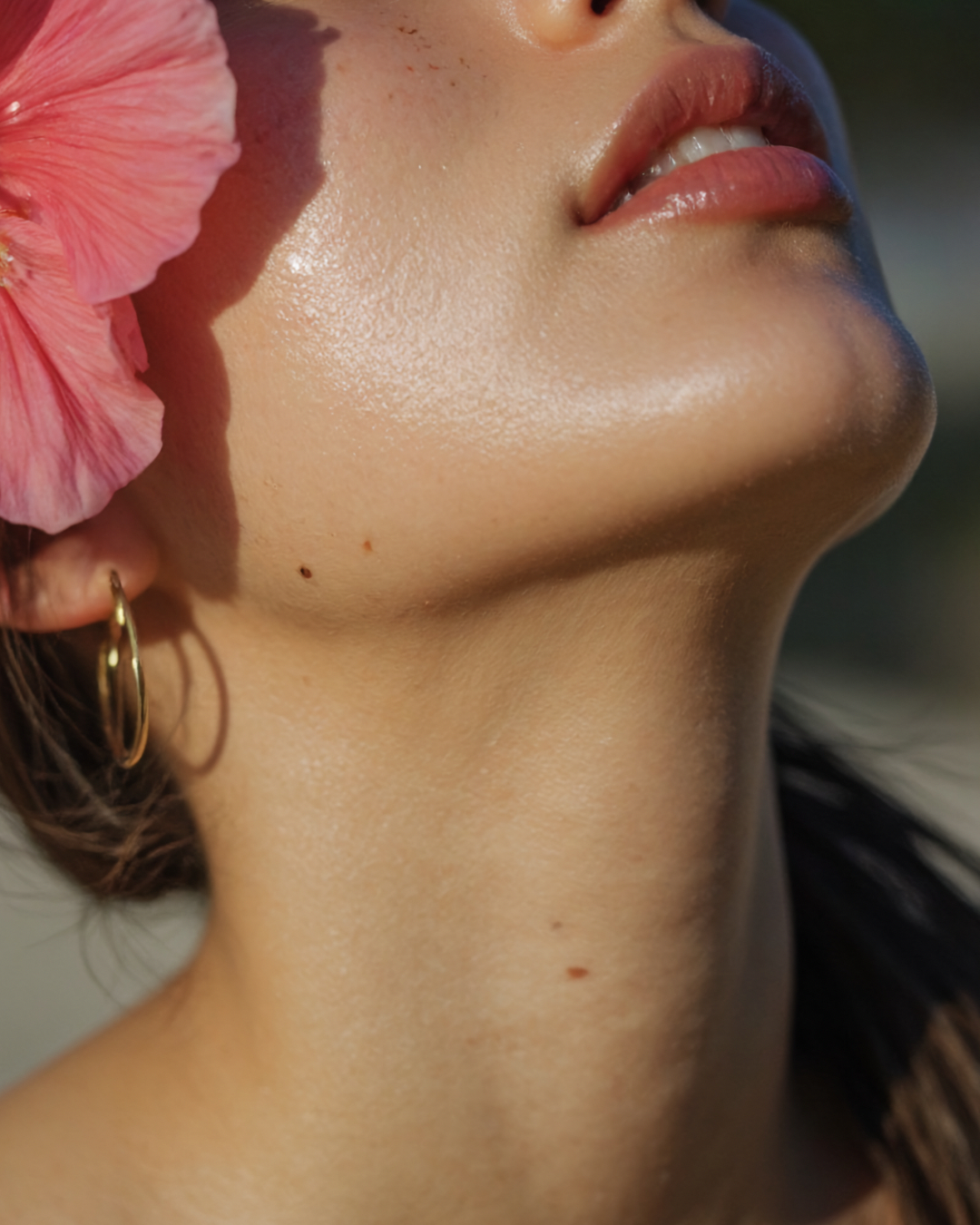 Fotona Erbium YAG Laser resurfacing