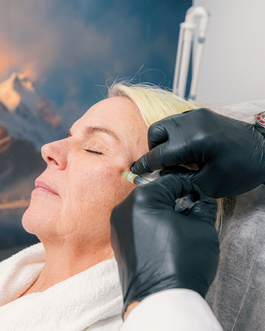 PRF Liquid Full Facial Rejuvenation