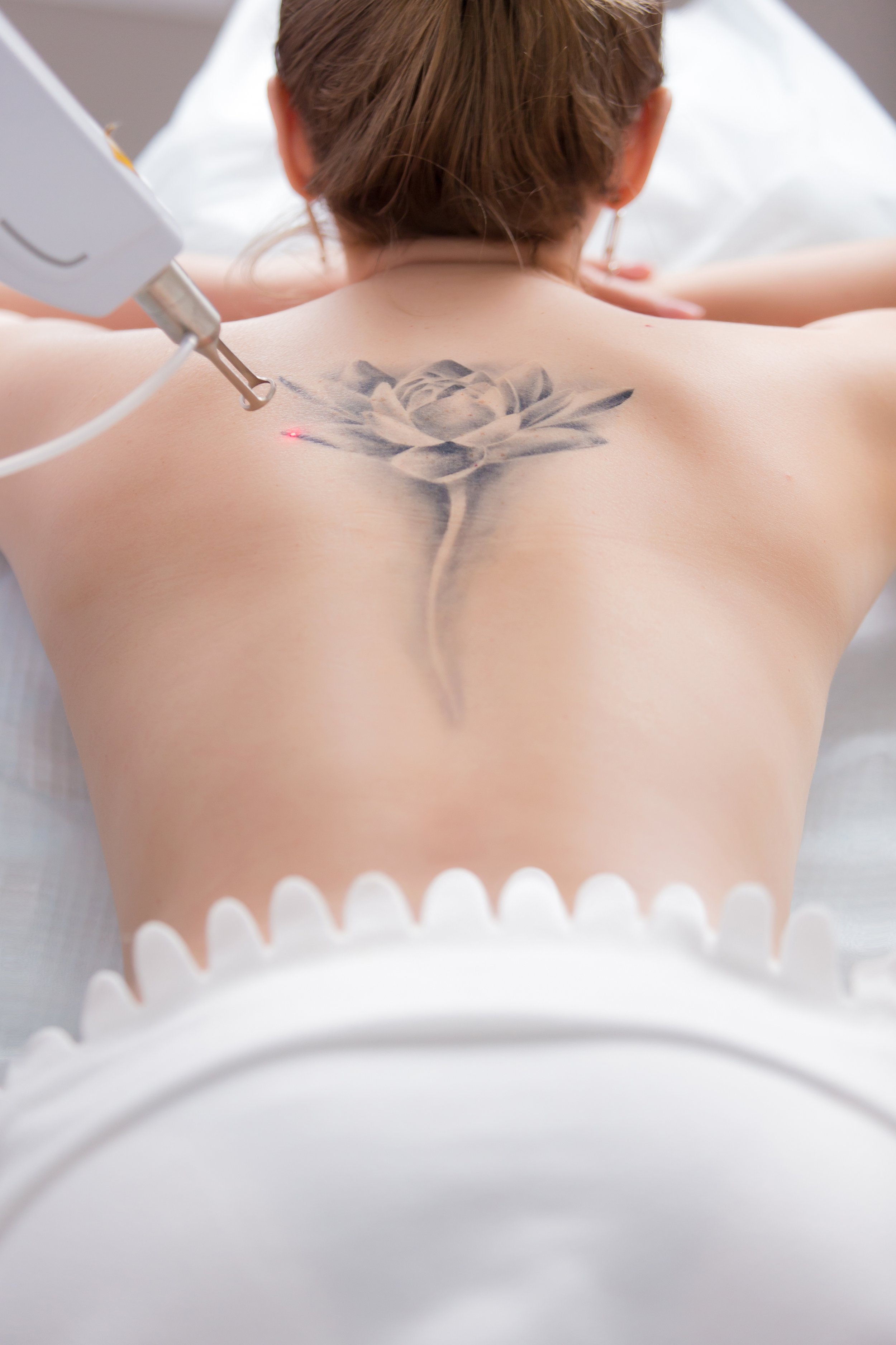 Person receiving a tattoo of a detailed black and gray rose on their upper back with a laser tattoo removal device nearby.