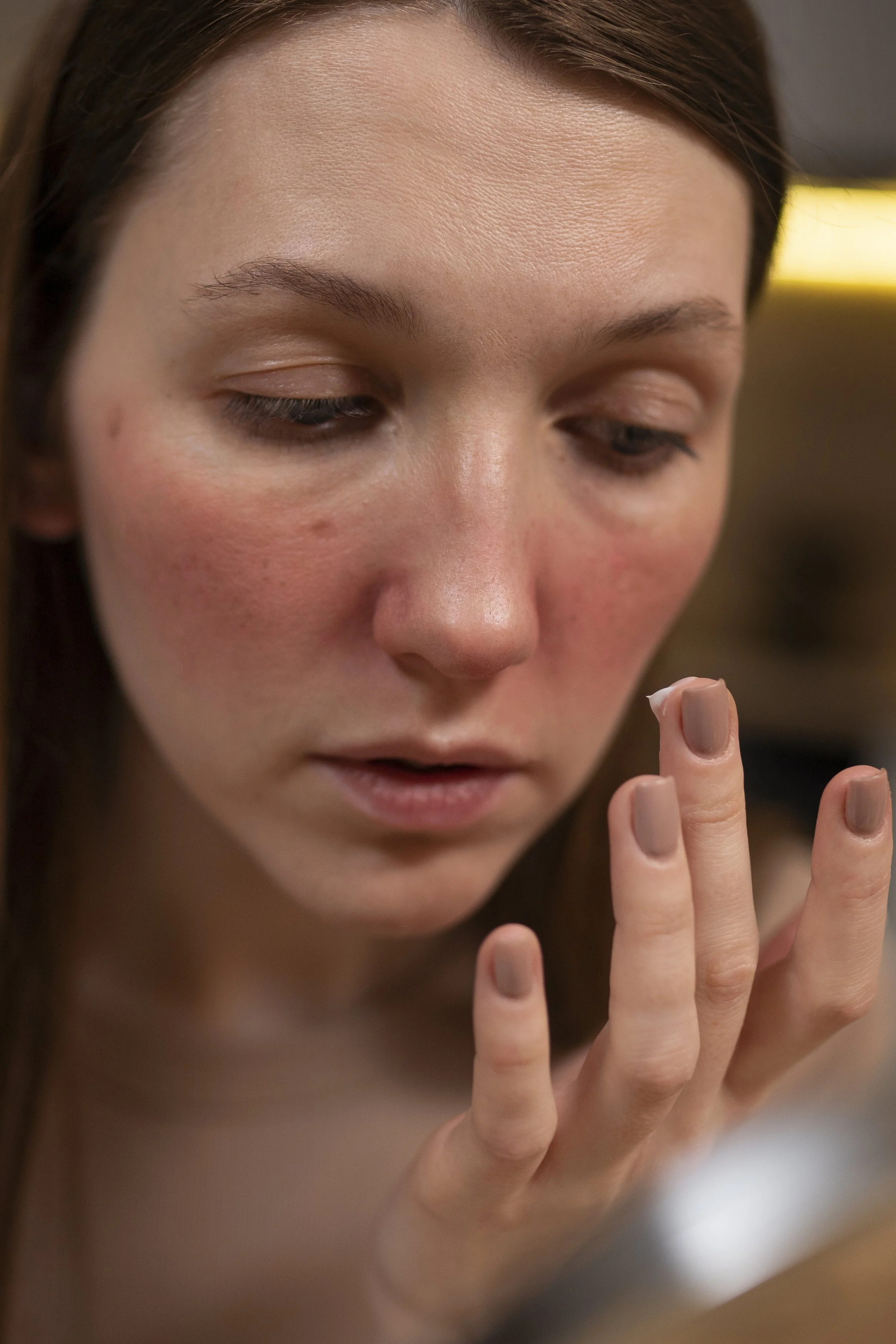 Rosacea &amp; Redness Correction