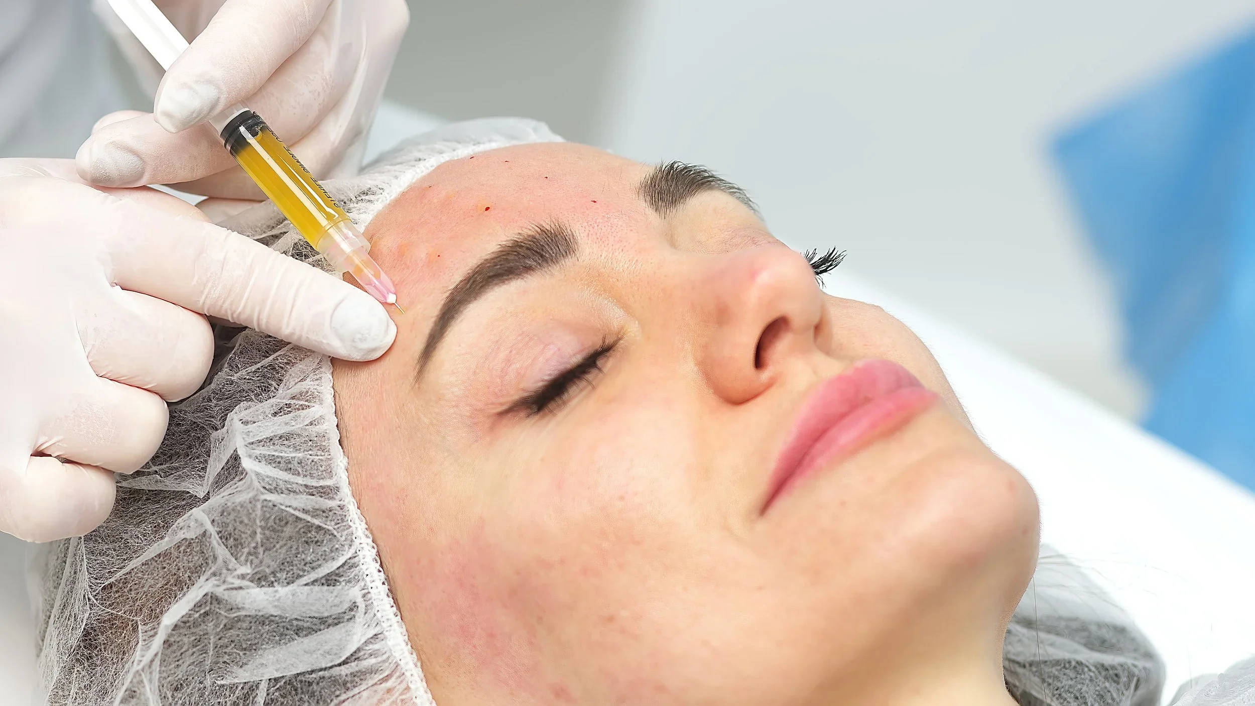 BioFiller™ (PRF EZ Gel Natural Filler Alternative)