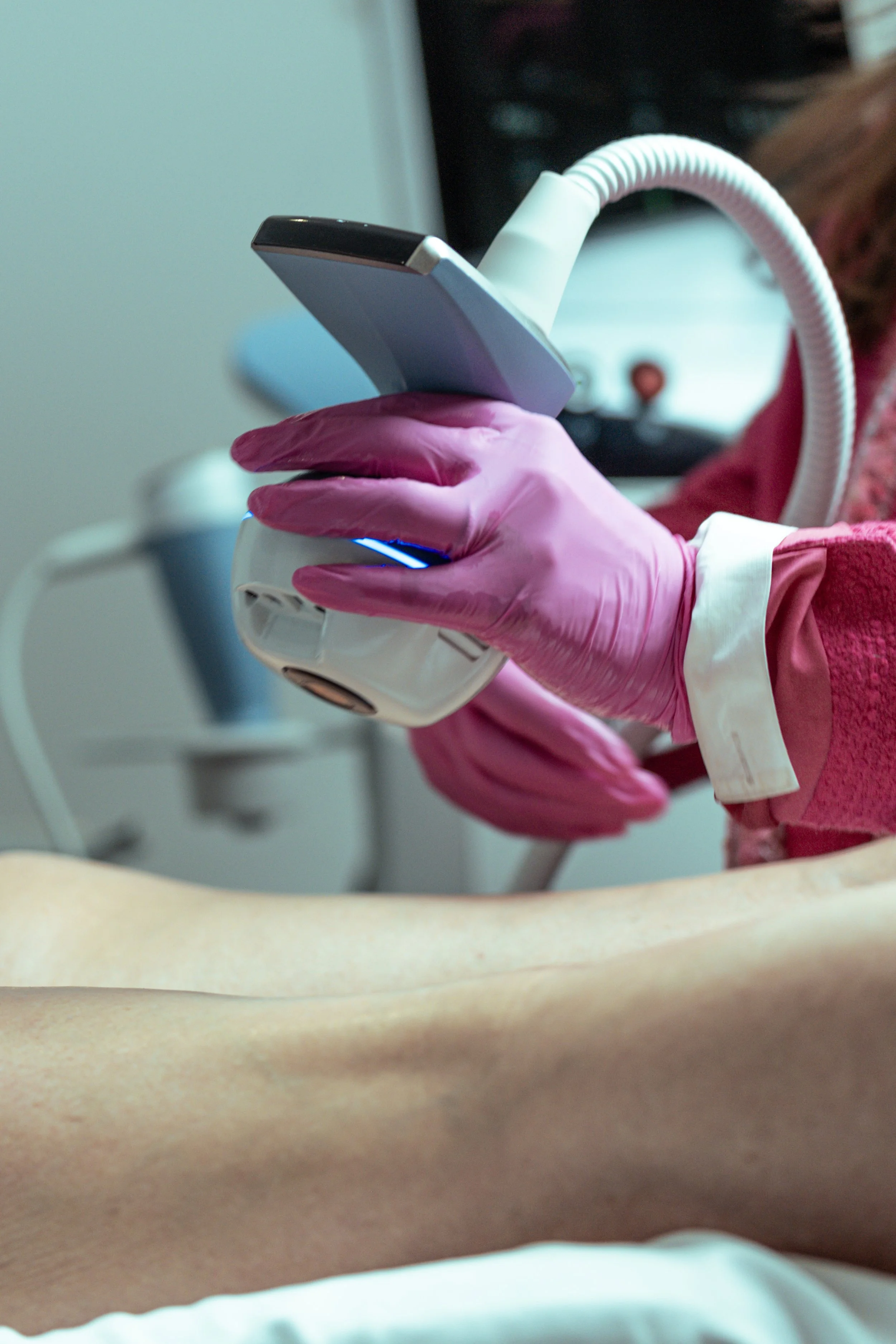 Exion® Body RF Skin Tightening &amp; Cellulite Improvement