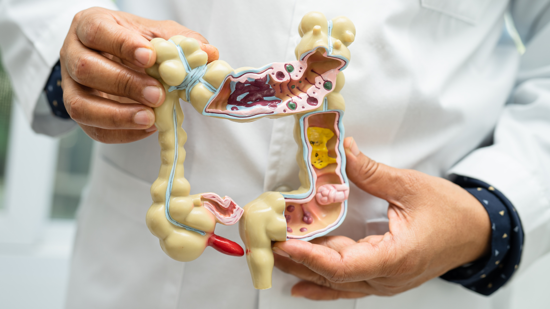 The Vital Role of Polyphenols in Nutrition and Health — Whole Body ...
