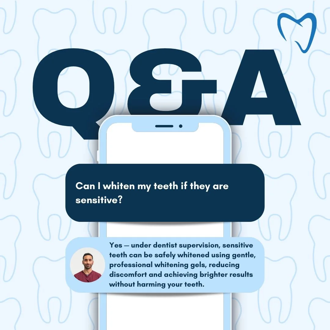 Sensitive teeth? You can still whiten safely!

When whitening is done under dentist supervision, even sensitive smiles can shine brighter. 

At Elite Smile, we use specially formulated gels designed to:
✔️ Protect enamel
✔️ Reduce sensitivity
✔️ Deli
