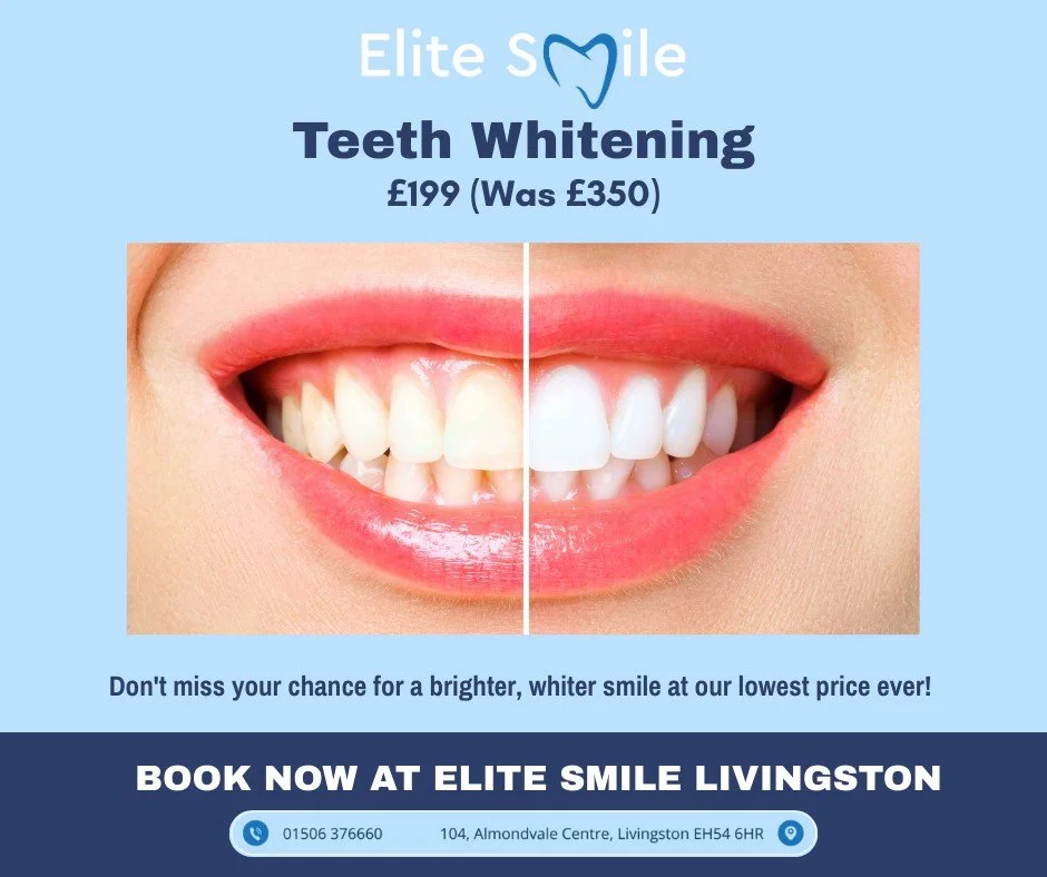 Our whitening offer ends on 30th September ⏰

Whitening with Elite Smile is safe, dentist-supervised, and designed to deliver natural results without harming your teeth. If you&rsquo;ve been considering a brighter smile, now is the perfect time.

Boo
