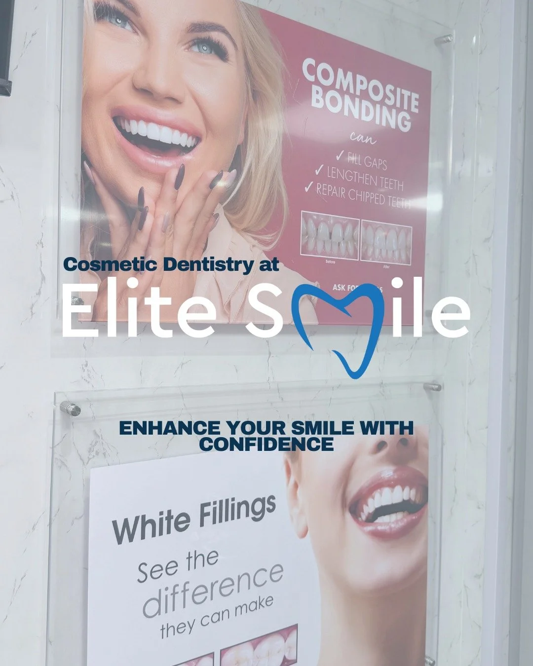 Thinking about enhancing your smile? ✨
At Elite Smile Livingston, we offer modern cosmetic treatments designed to boost confidence and create natural-looking results.

From professional teeth whitening and Invisalign&reg; to composite bonding, our te