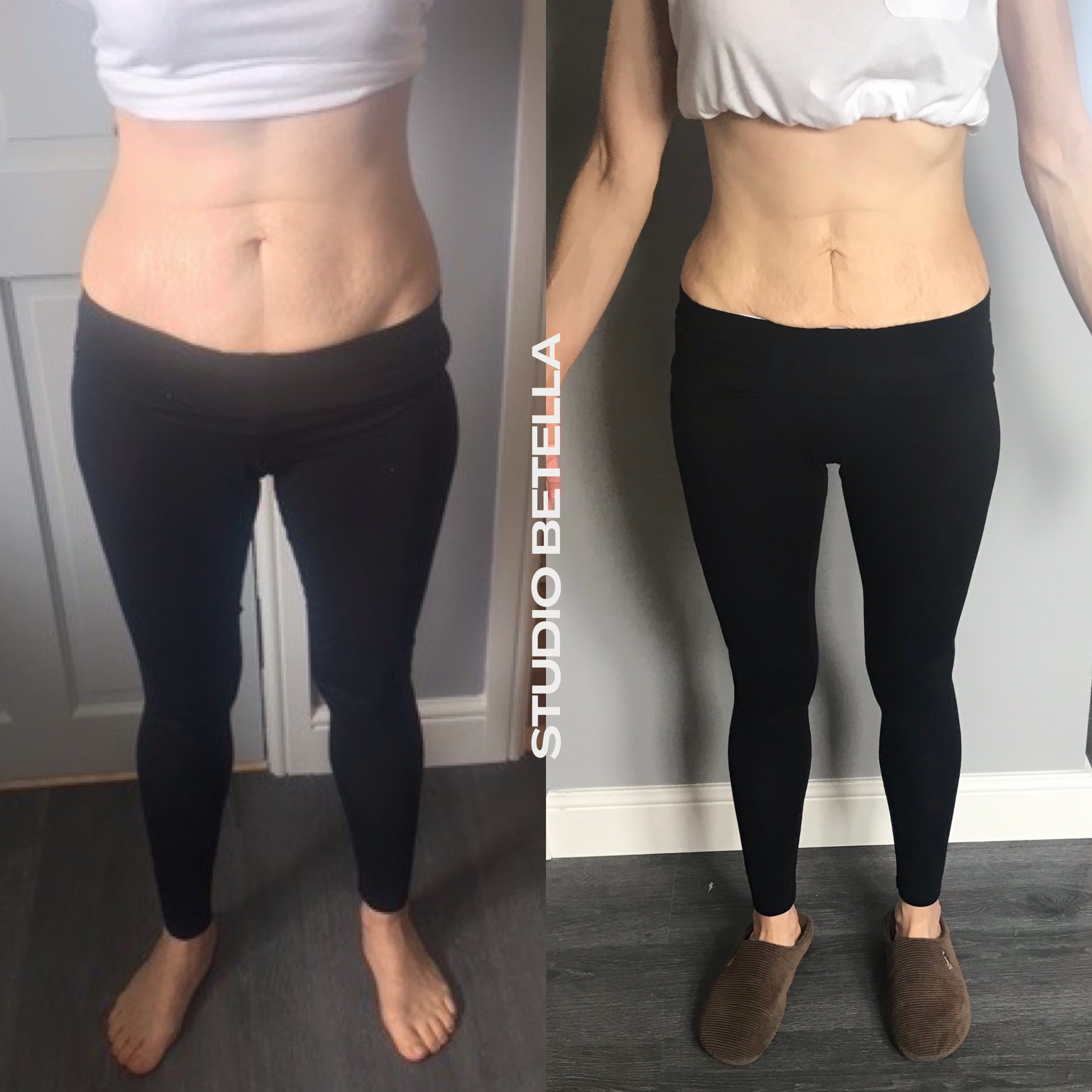 slim-legs-38.png