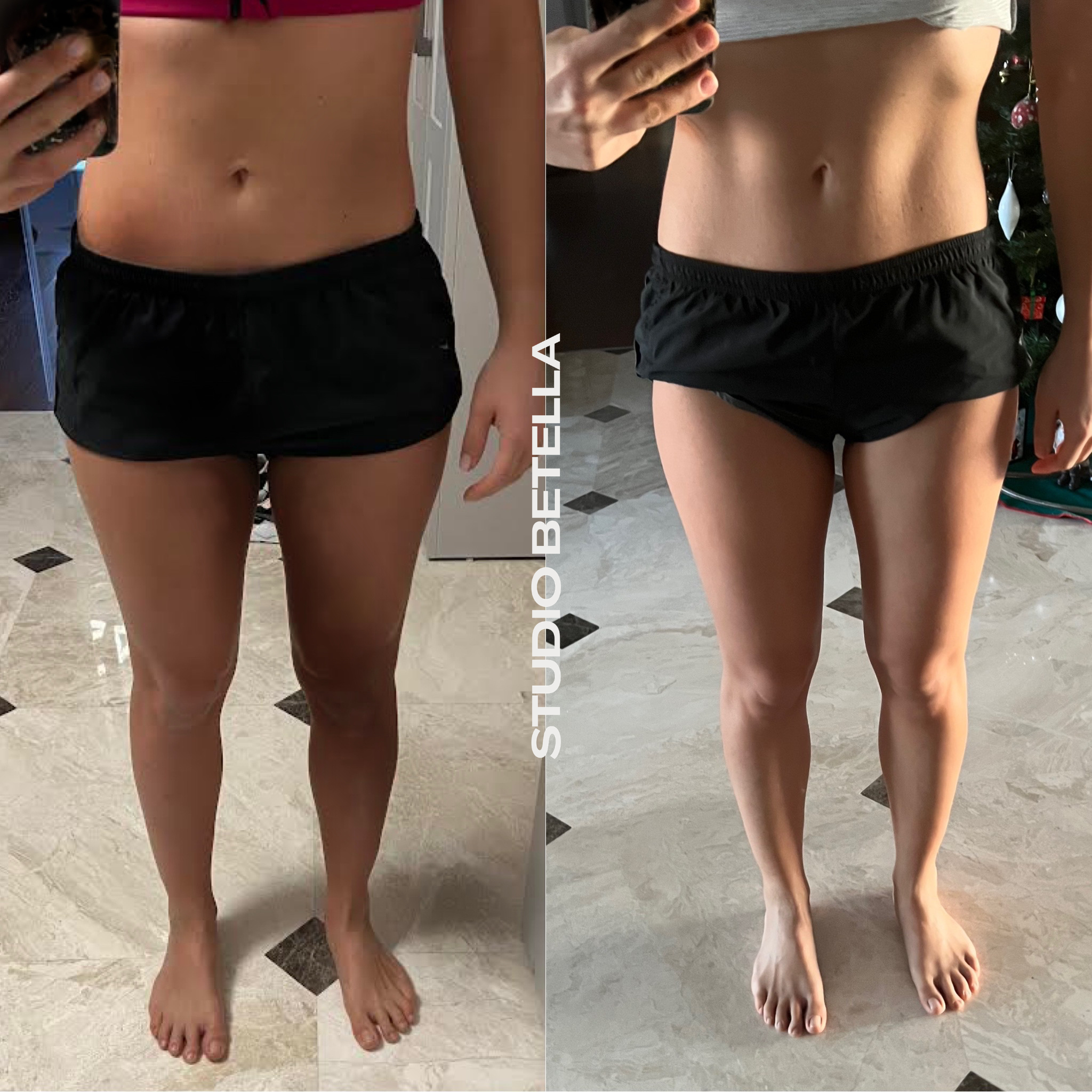 slim-legs-5.png
