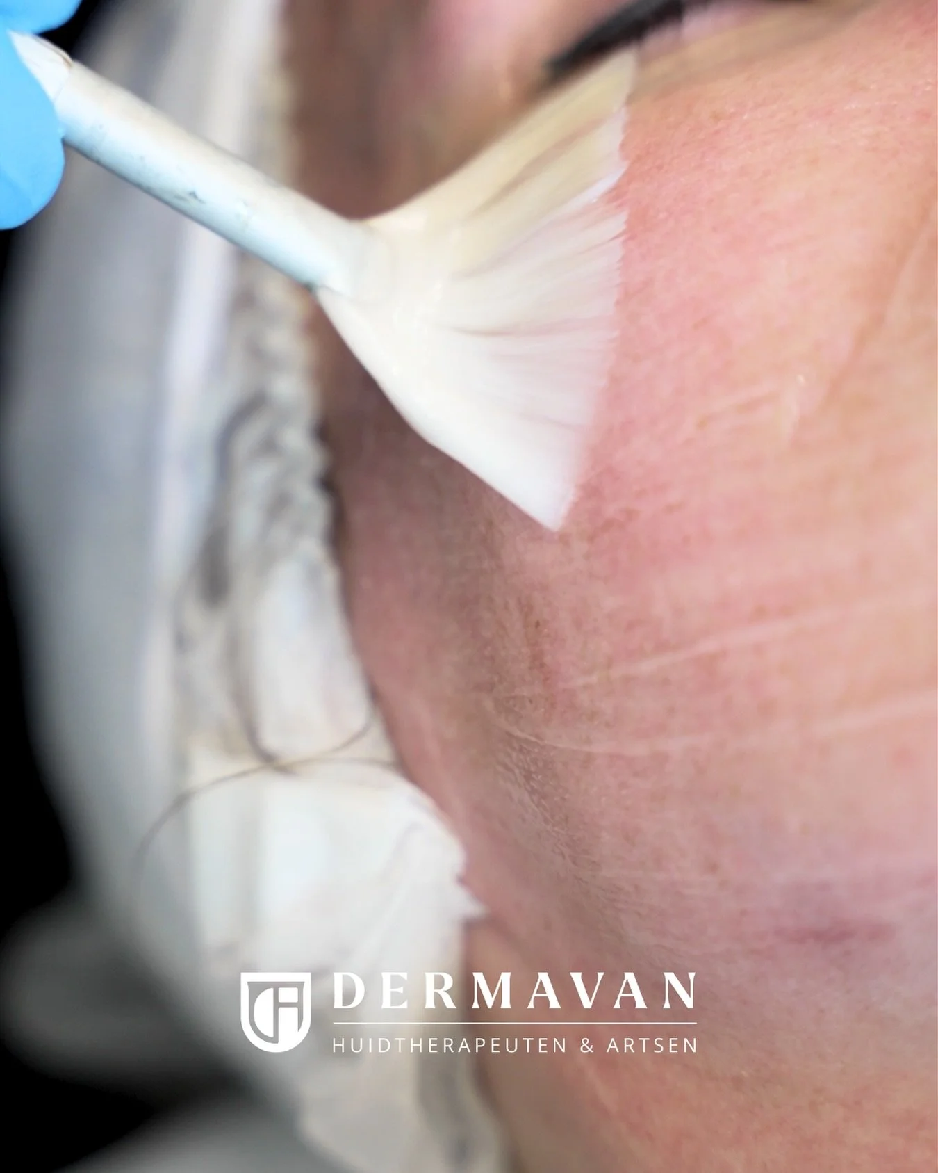 🇳🇱 Top Rated 2025 – Dermavan! 🏆✨
Wij zijn ontzettend trots om te mogen delen dat Dermavan dit jaar door Treatwell is uitgeroepen tot een Top Rated Salon!
Dat betekent dat onze cliënten ons het afgelopen jaar uitstekende beoordelingen h