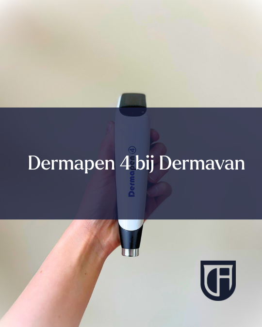 Dermapen 4 bij Dermavan