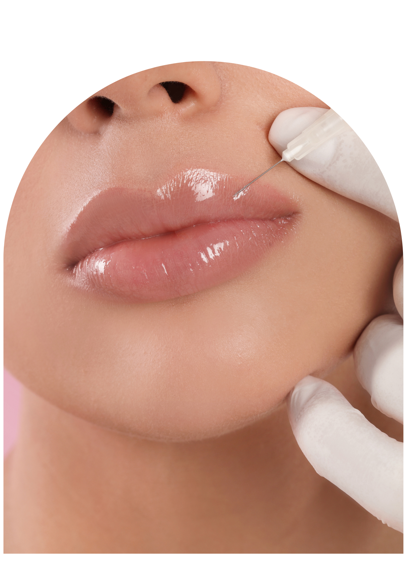 Renae Rose Aesthetics | Medspa in Edina, MN, 55424 | Botox, Fillers, Microneedling