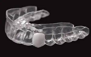 Essix Retainer After Extraction: Why We Use It and How to Care for It
