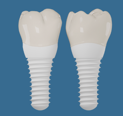 How to Care for Your Dental Implant: Simple Daily Habits That Can Help It Last for Years