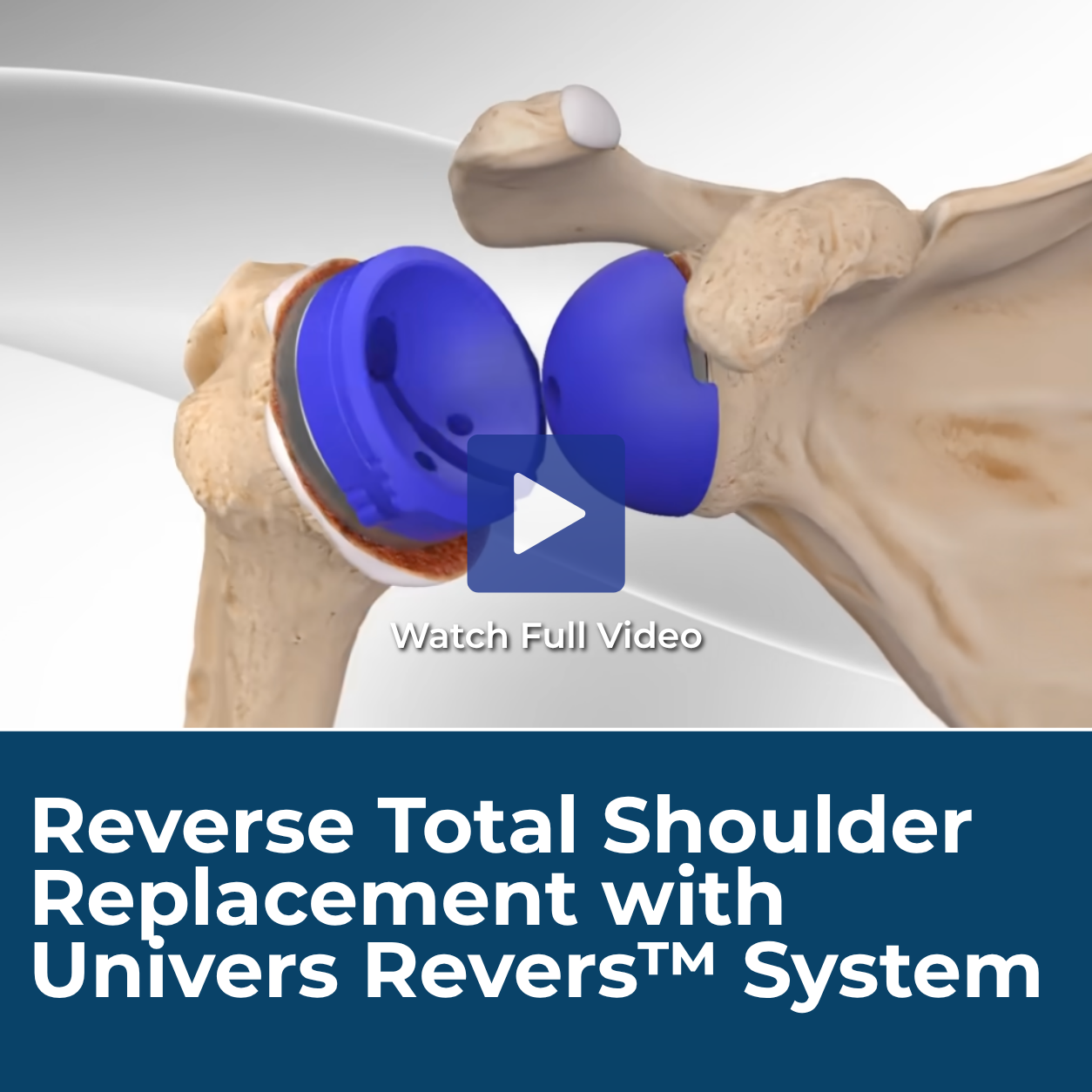 Univers Revers System - Shoulder.png