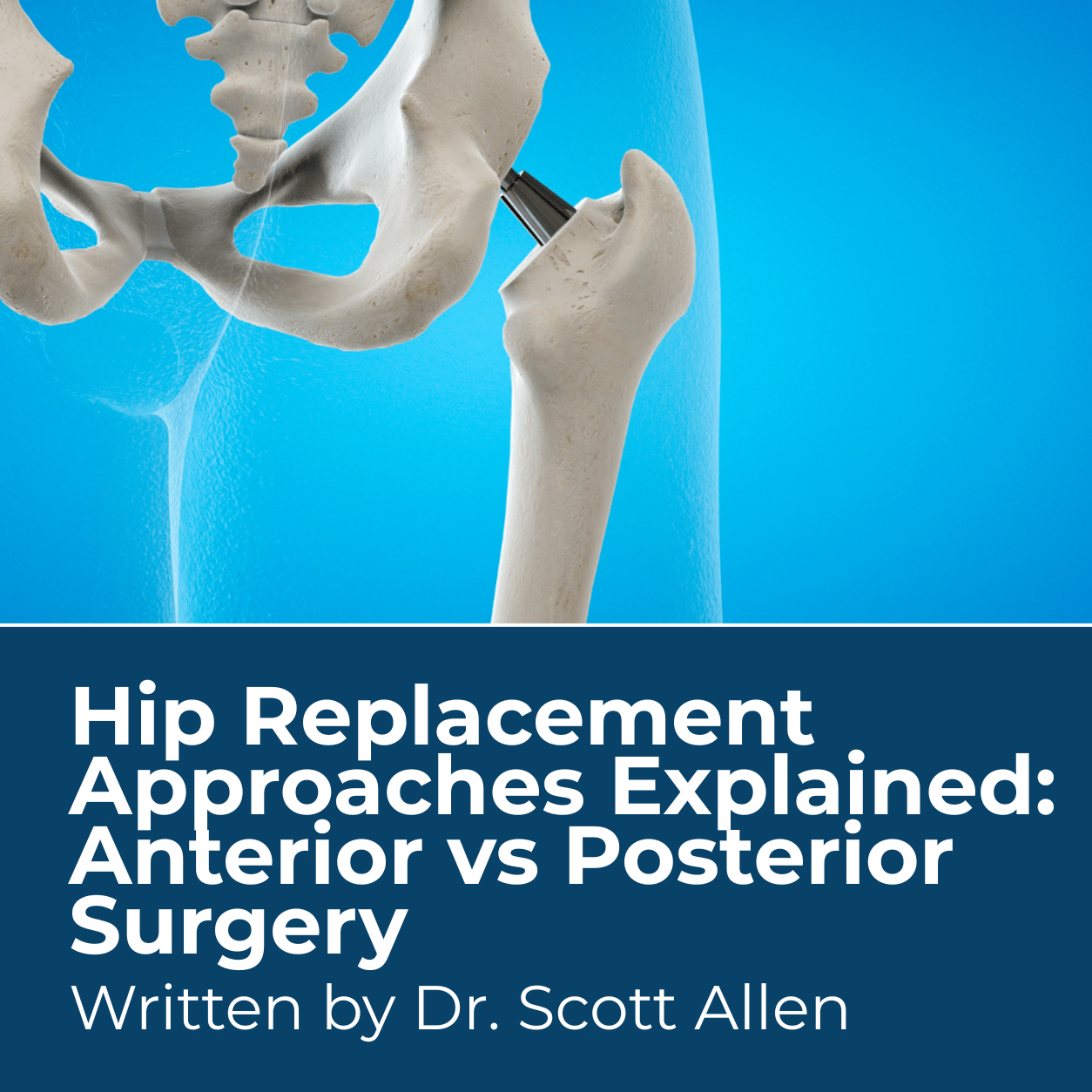 Anterior vs Posterior.png