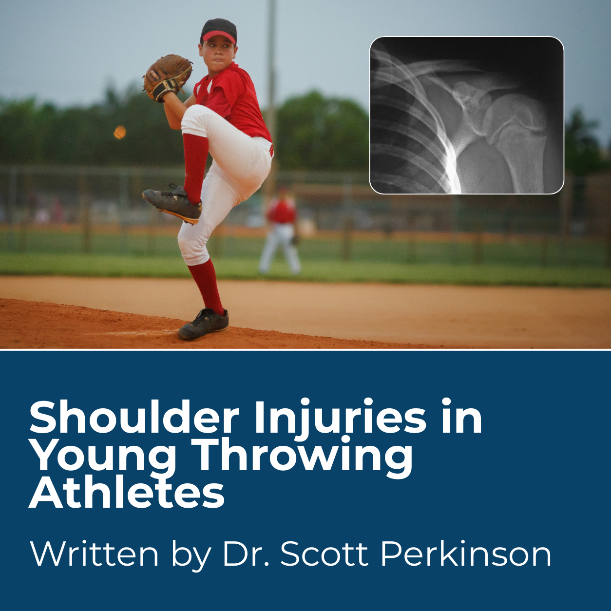 ShoulderInjuries.png