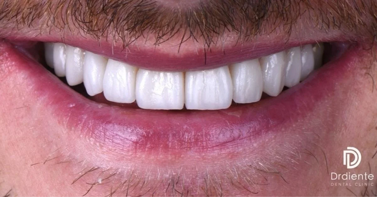 ¿Cómo se define la proporción correcta entre longitud y ancho dental?