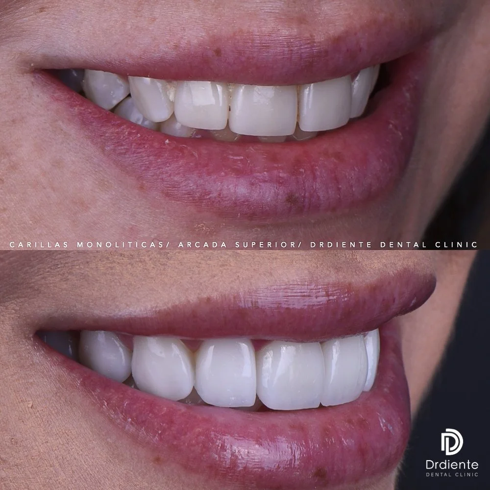 MARCELA 1 FEED LATERAL DERECHA.jpg