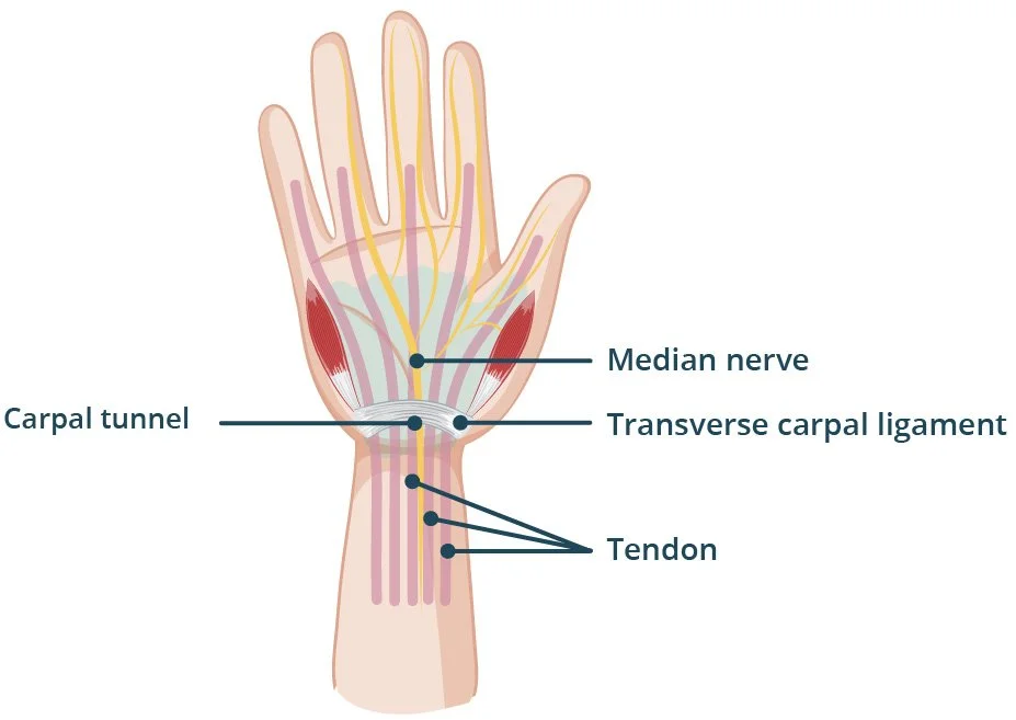 Carpal Tunnel