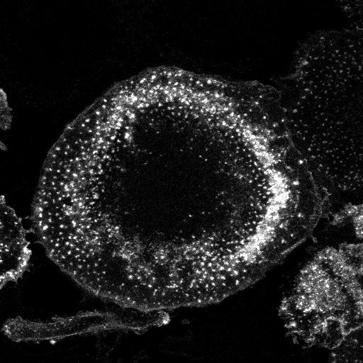 osteoclast attachement sites.jpg