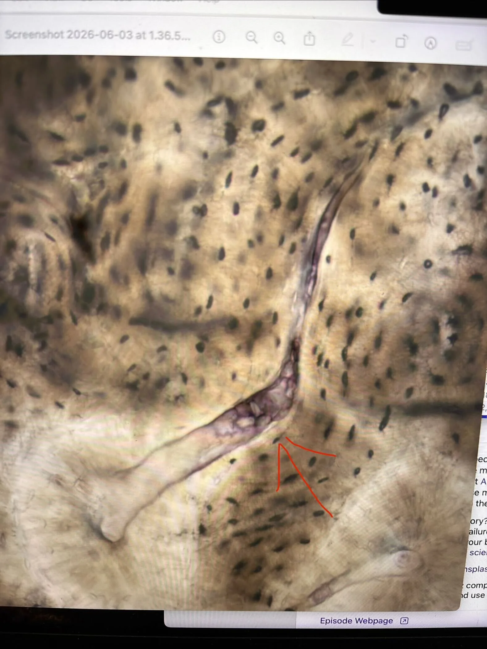 Hungry osteoclasts be chompin'
