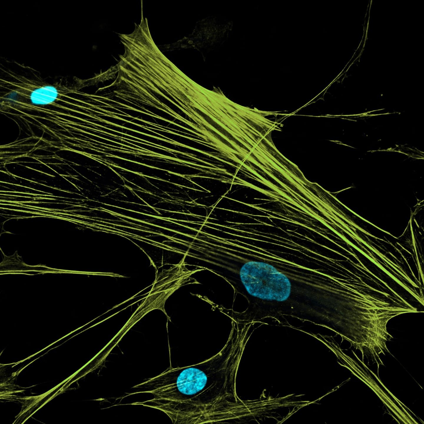 Actin Cytoskeleton of Human Osteoprogenitors isolated from tribecular bone