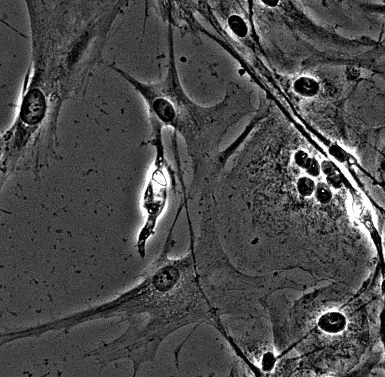 fun osteo with osteoblasts.jpg