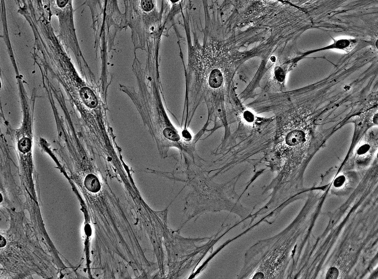 osteoblasts.jpg