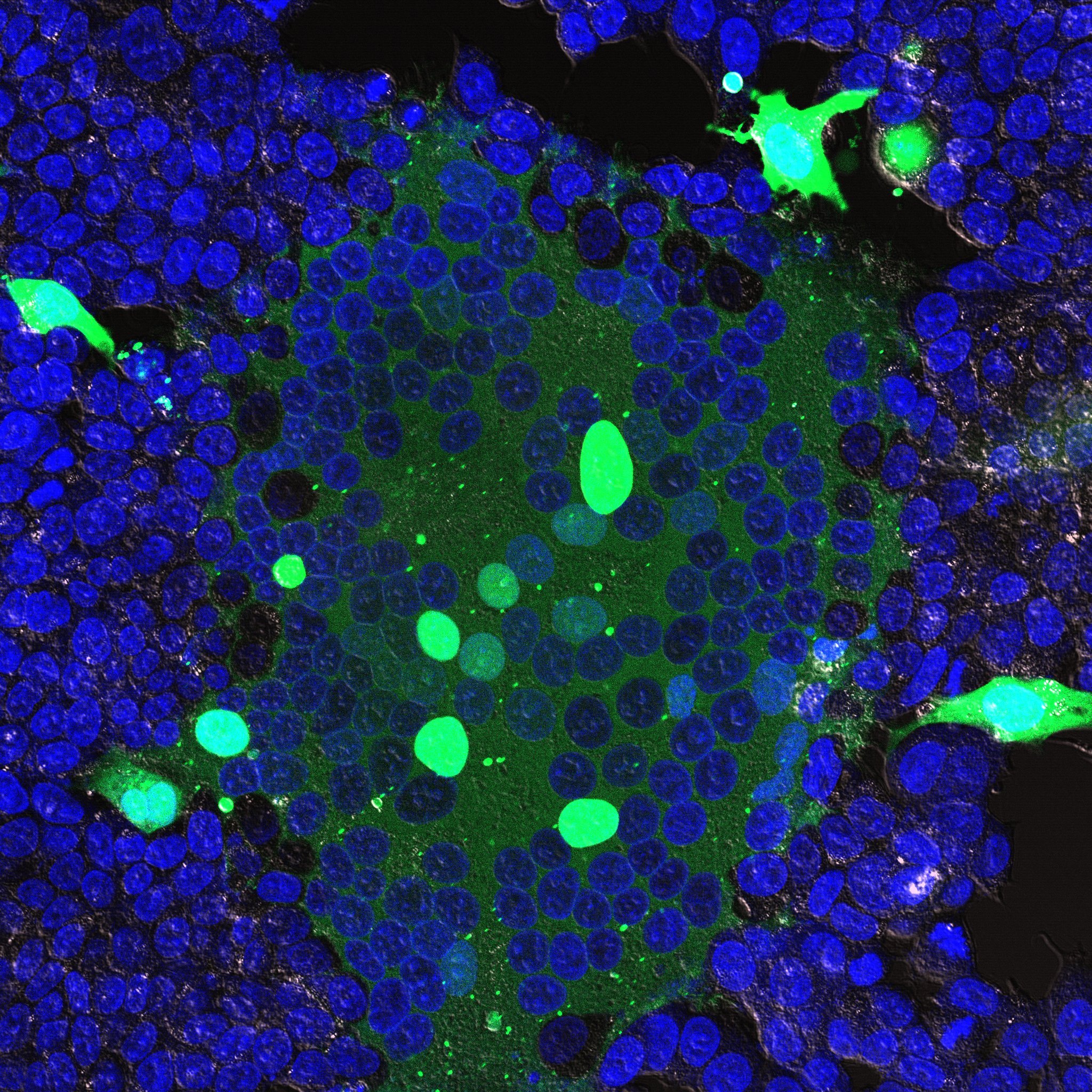Forced HeLa fusion mediated by SYN1-hyperfusion mutant
