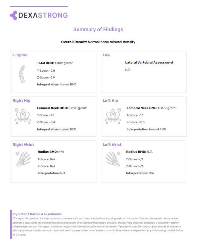 Sample DexaStrong DEXA bone density report showing spine and hip T-scores and Z-scores