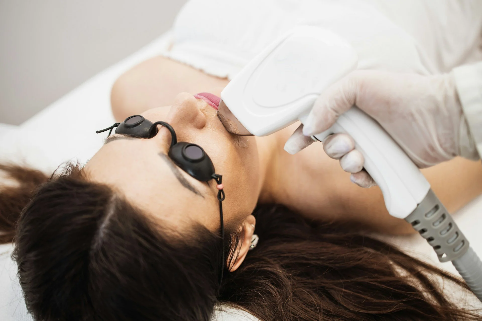 Treating Pigmentation With Laser Therapy on the Gold Coast