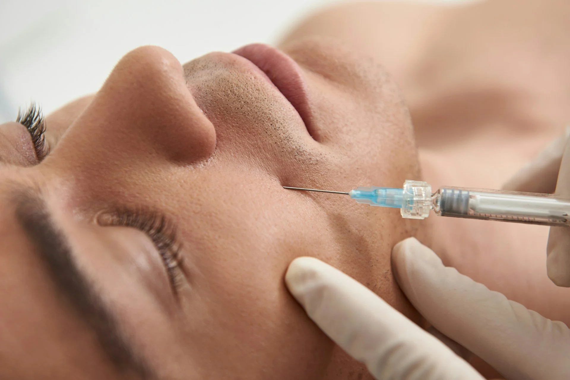 Should You Consider PDRN Treatment for Post-Winter Skin?