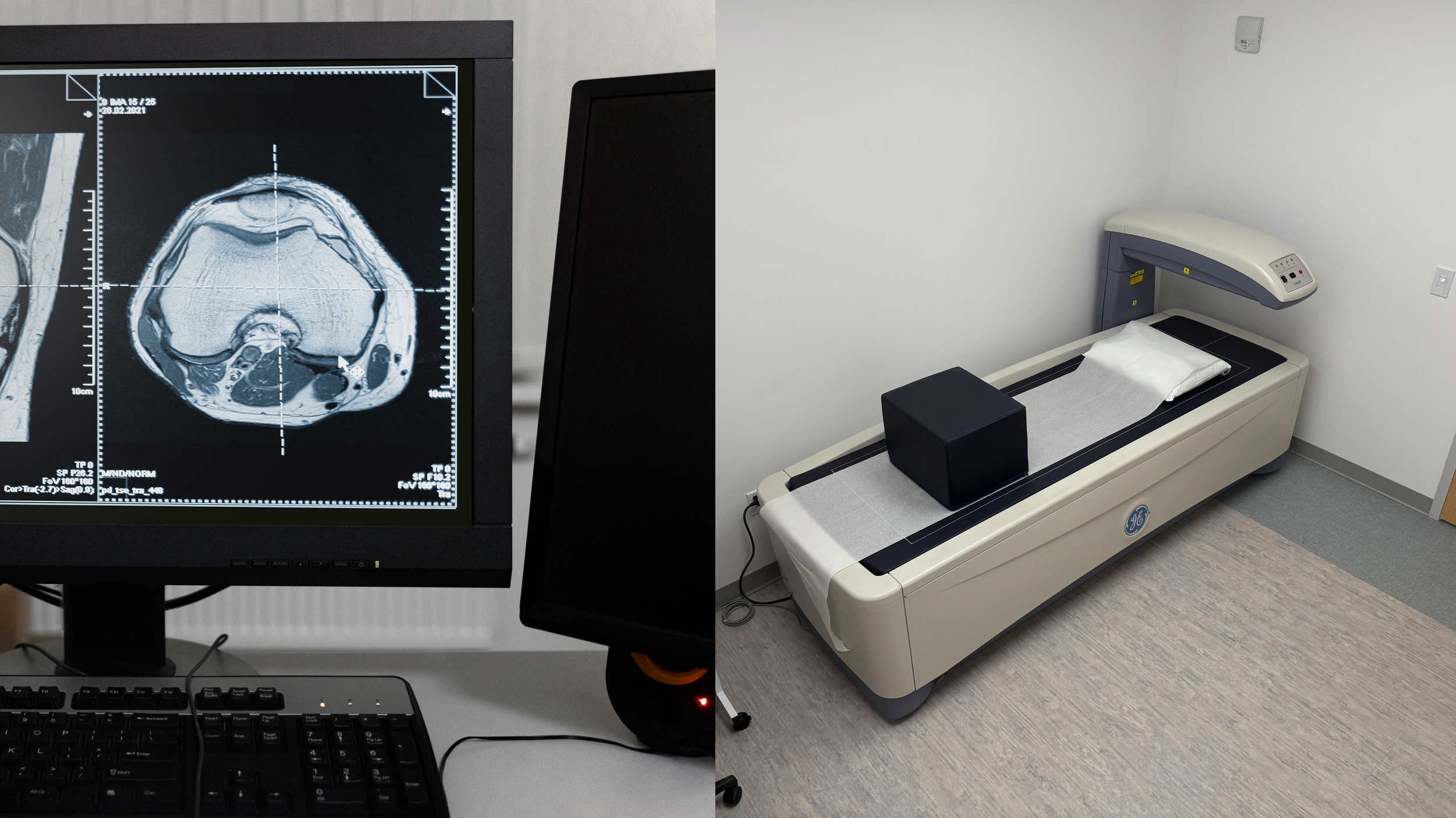 Strengthening Your Foundation: Bone Health, Body Composition, and the Power of DEXA Scans