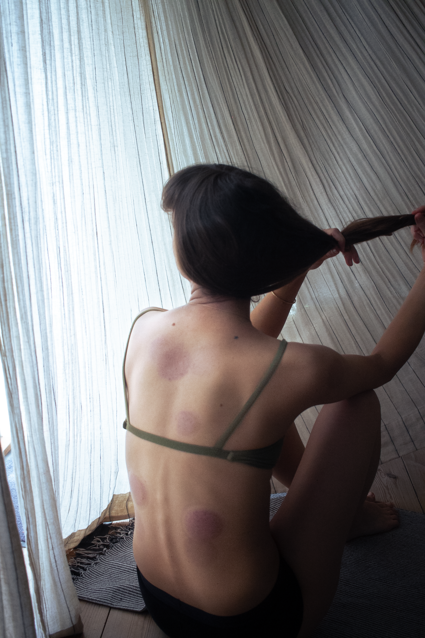 cupping massage