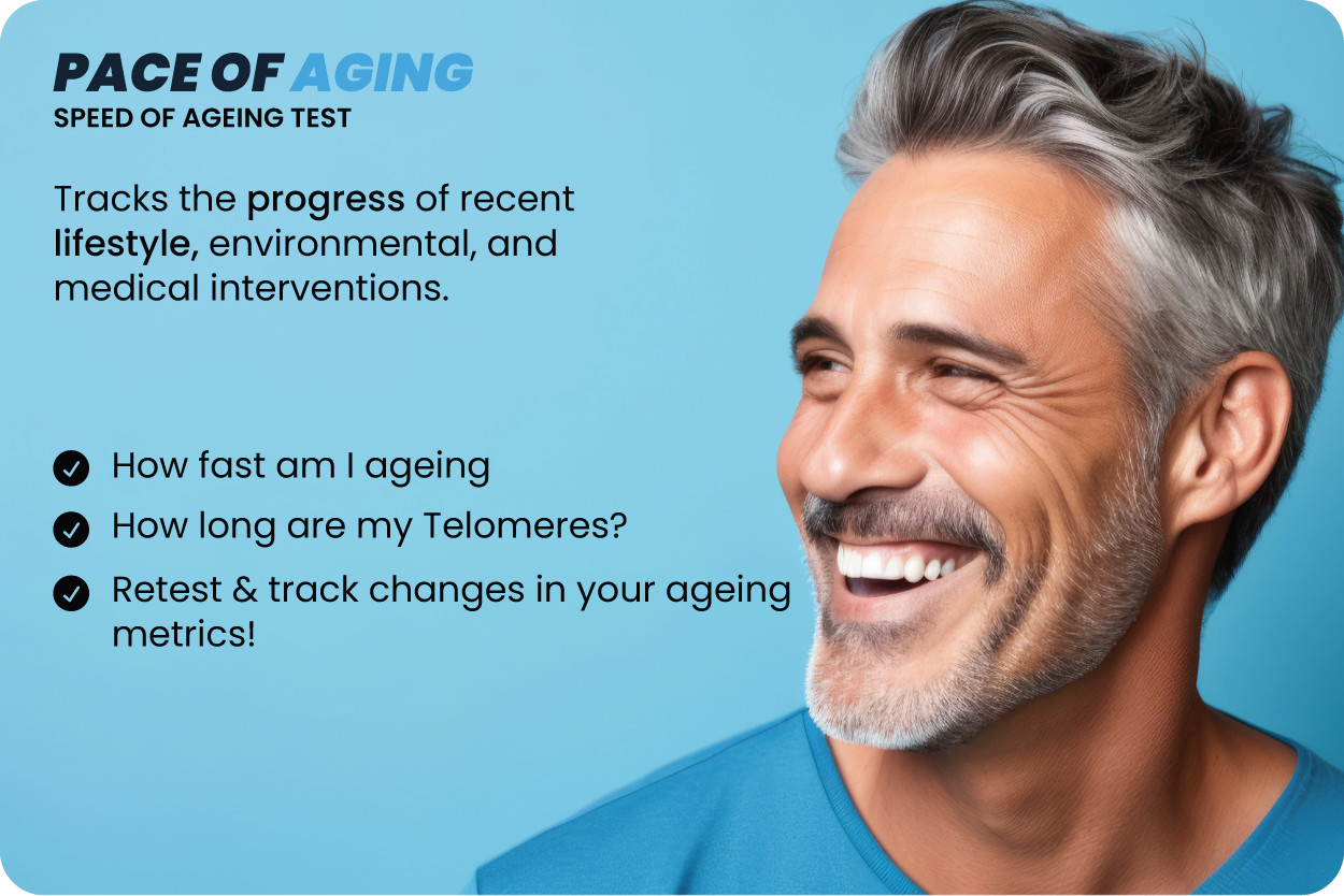 Carousel UK Pace.png