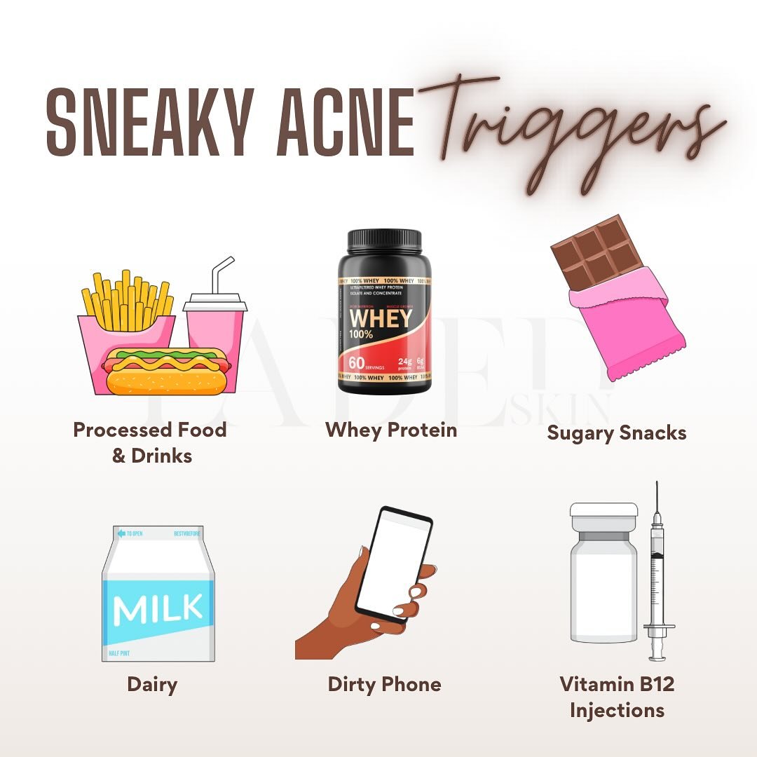 Have you come across any of these acne triggers before?🤔
.
PROCESSED FOODS: These have a high sugar content with low quality inflammatory ingredients that have no nutritional value. These foods have a high glycemic index, which can cause blood sugar