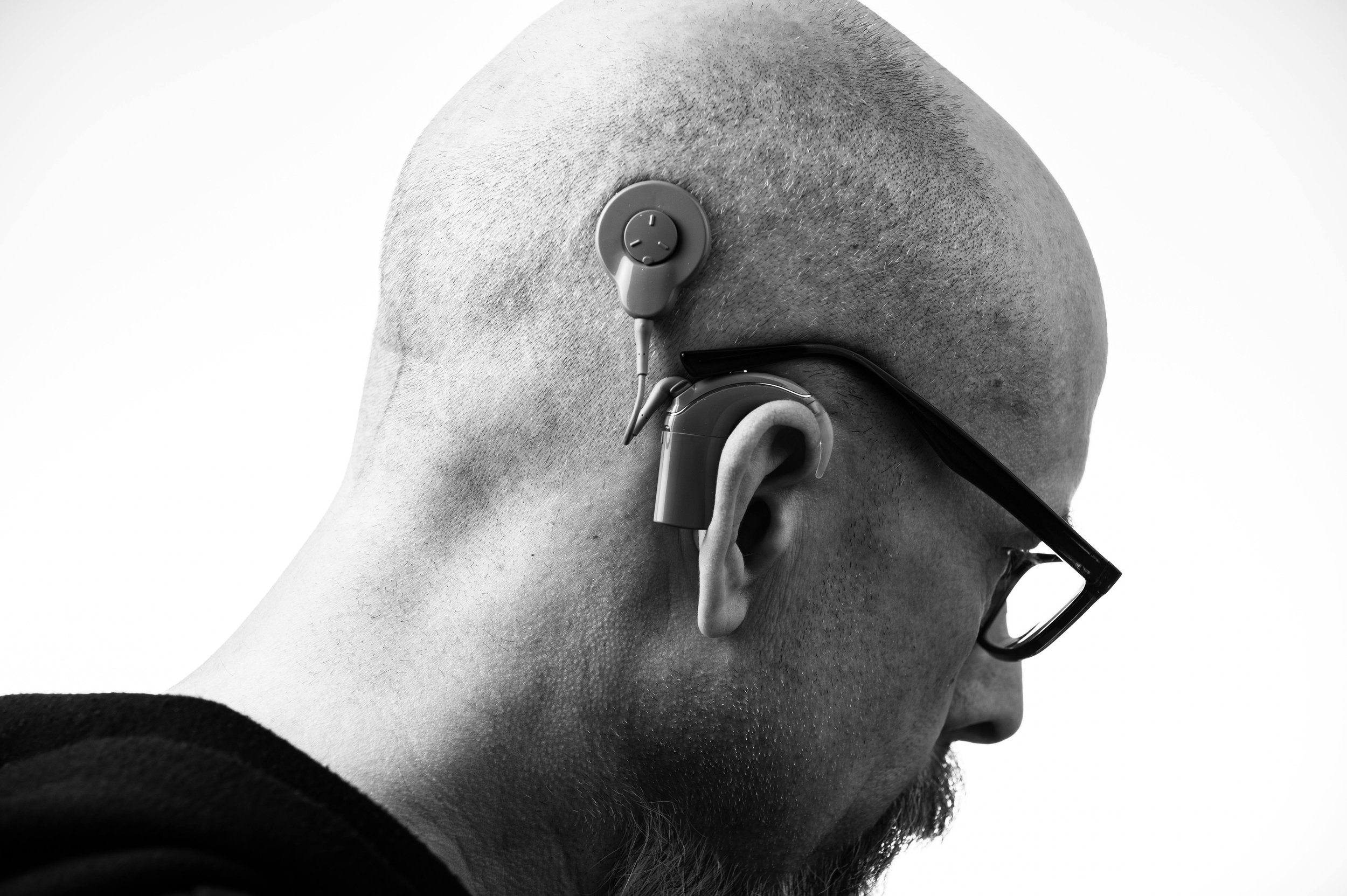 Beyond the Volume: What No One Tells You About Hearing Loss