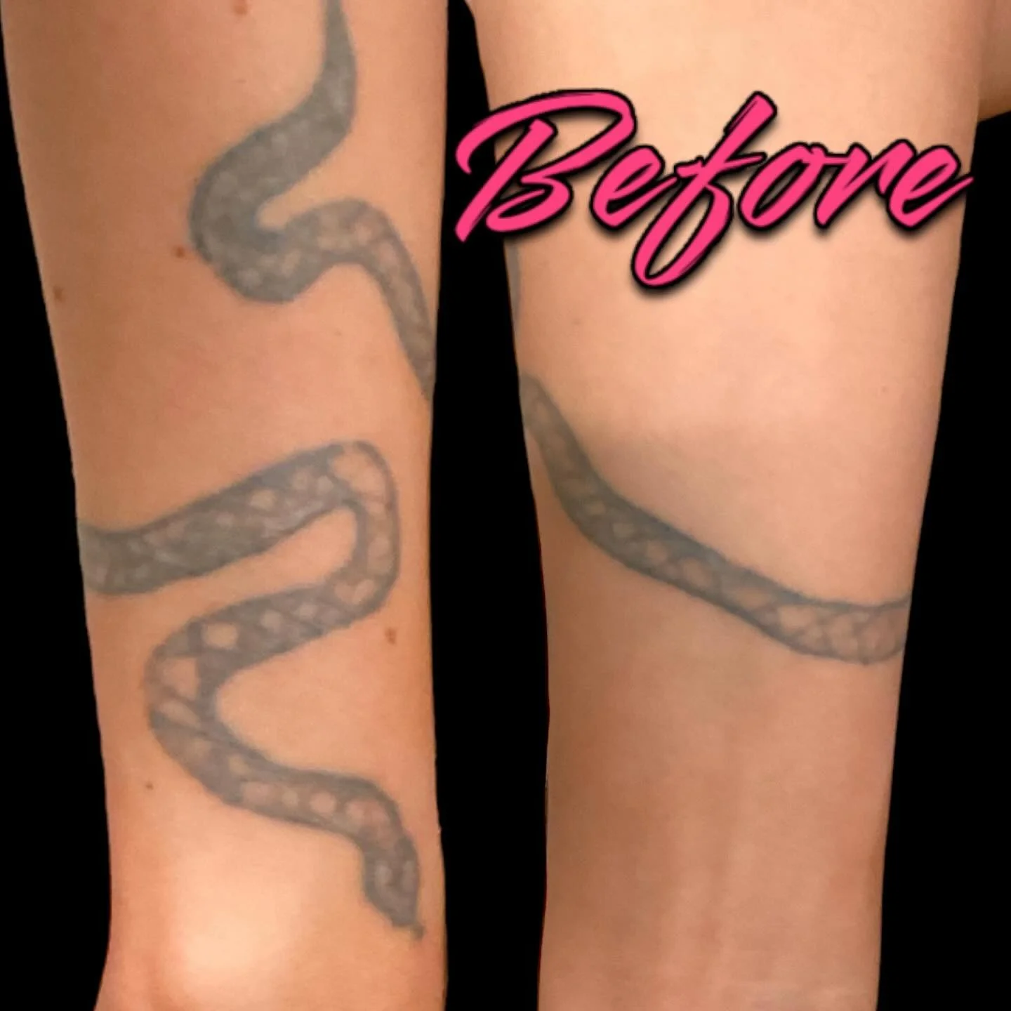 Cover up before and after by @jonezyzaps at our private studio @heartinhand_est in #deepellum.  Go to ianjonestattoos.com for bookings!⁠
#coverup #coveruptattoo #snaketattoo #serpenttattoo #heartinhand #elmstreettattoo