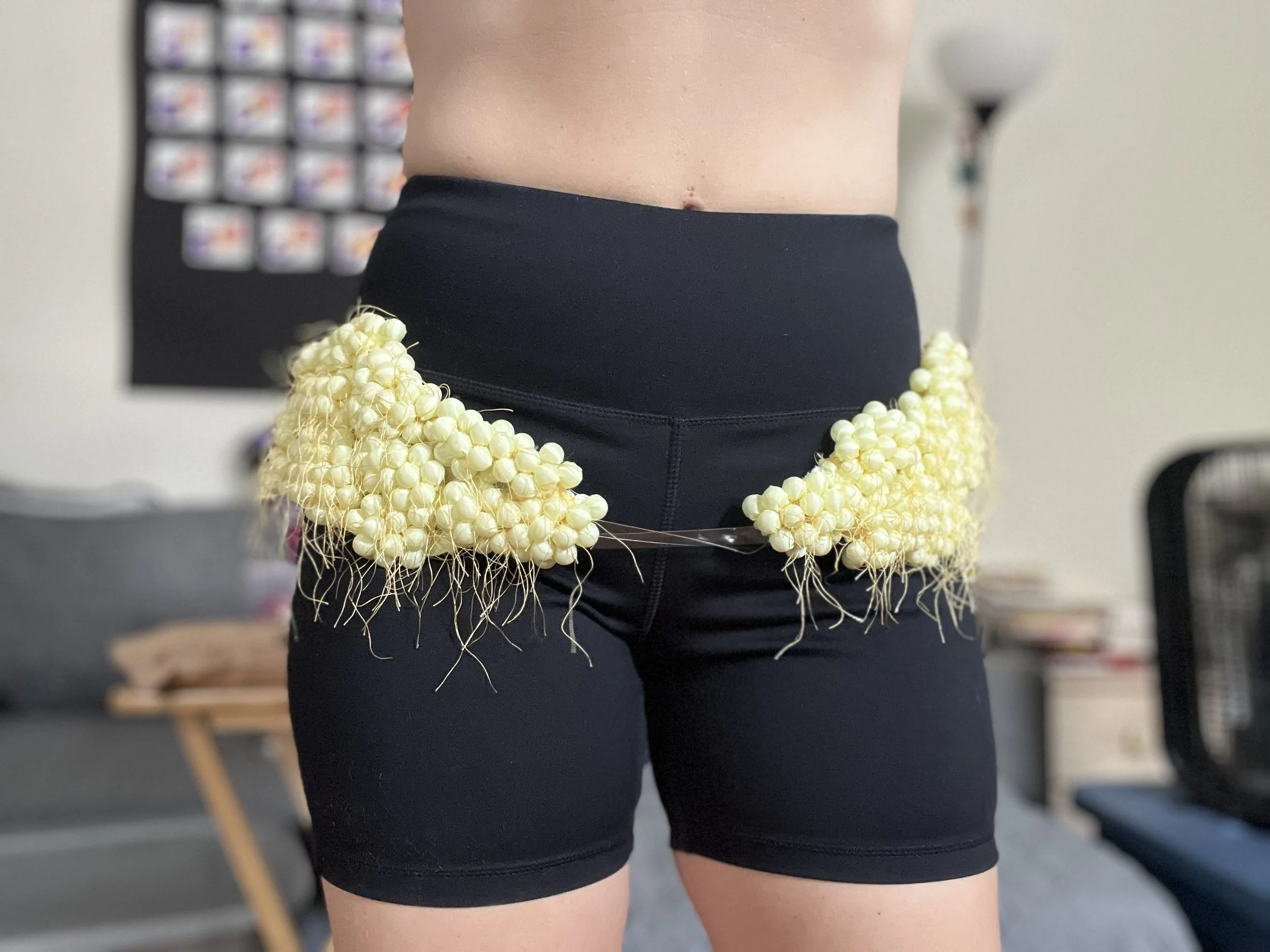 Staphylococci V: The Hips Hold Trauma