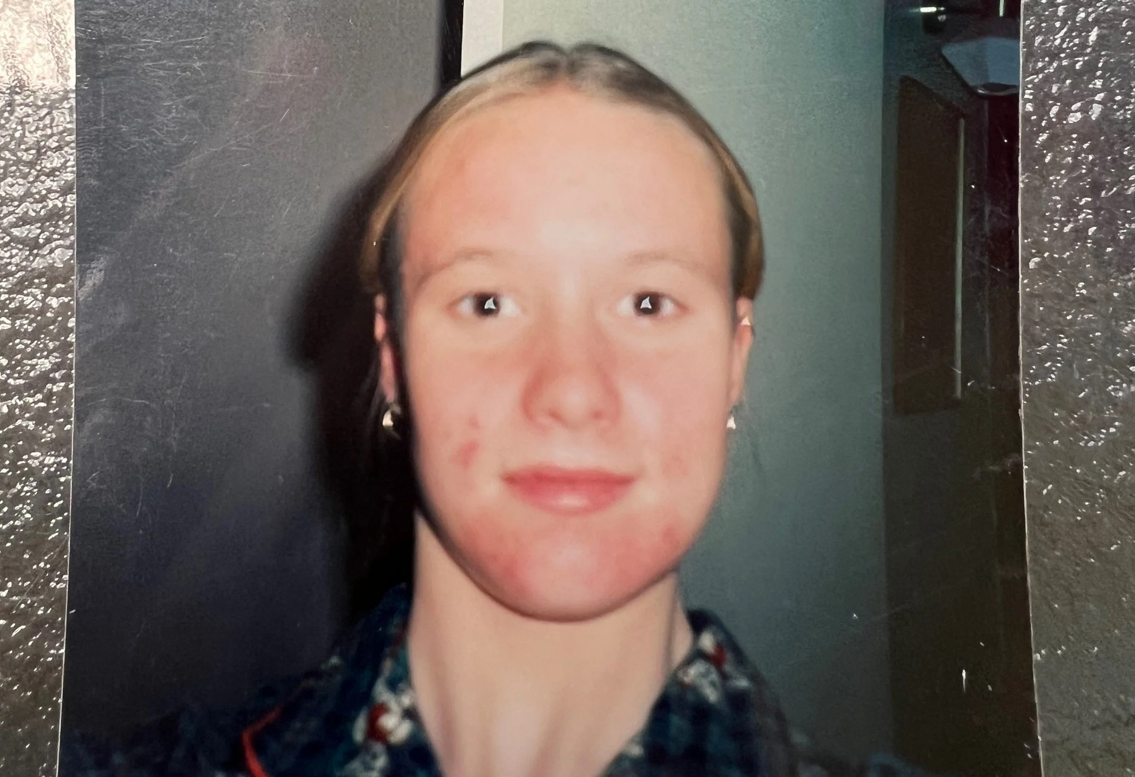 Michelle at age 14, a blurry photo of a photo, with cystic acne