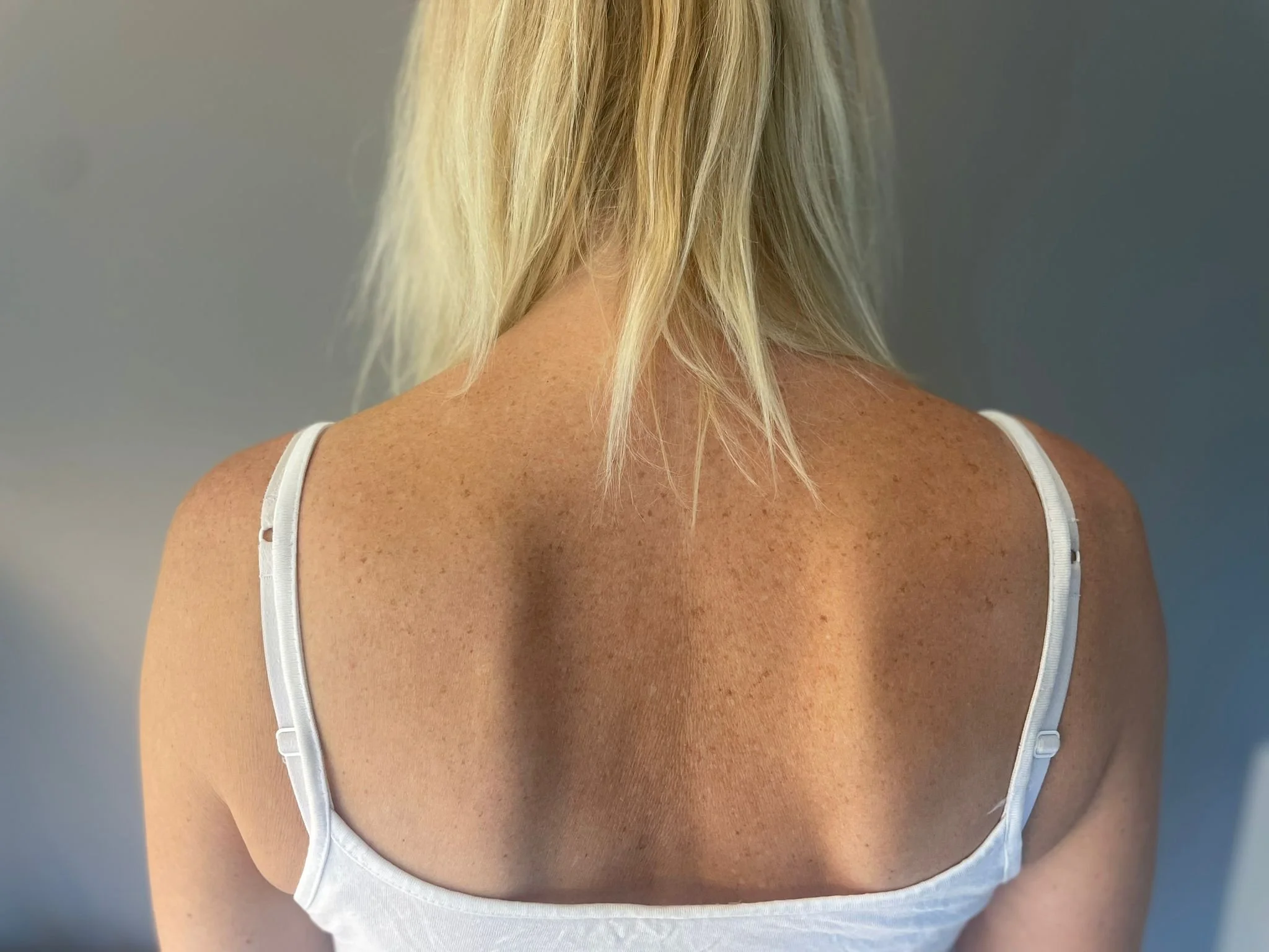 Rug-, nek- en/of schouderklachten? Corpus Liberum helpt